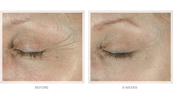 Obagi Elastiderm Eye Cream