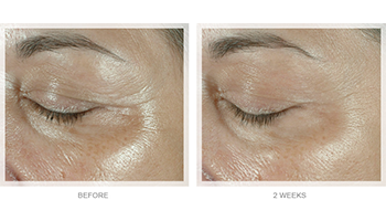 Obagi Elastiderm Eye Cream