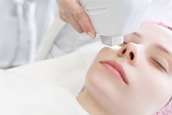 Acne IPL Treatment