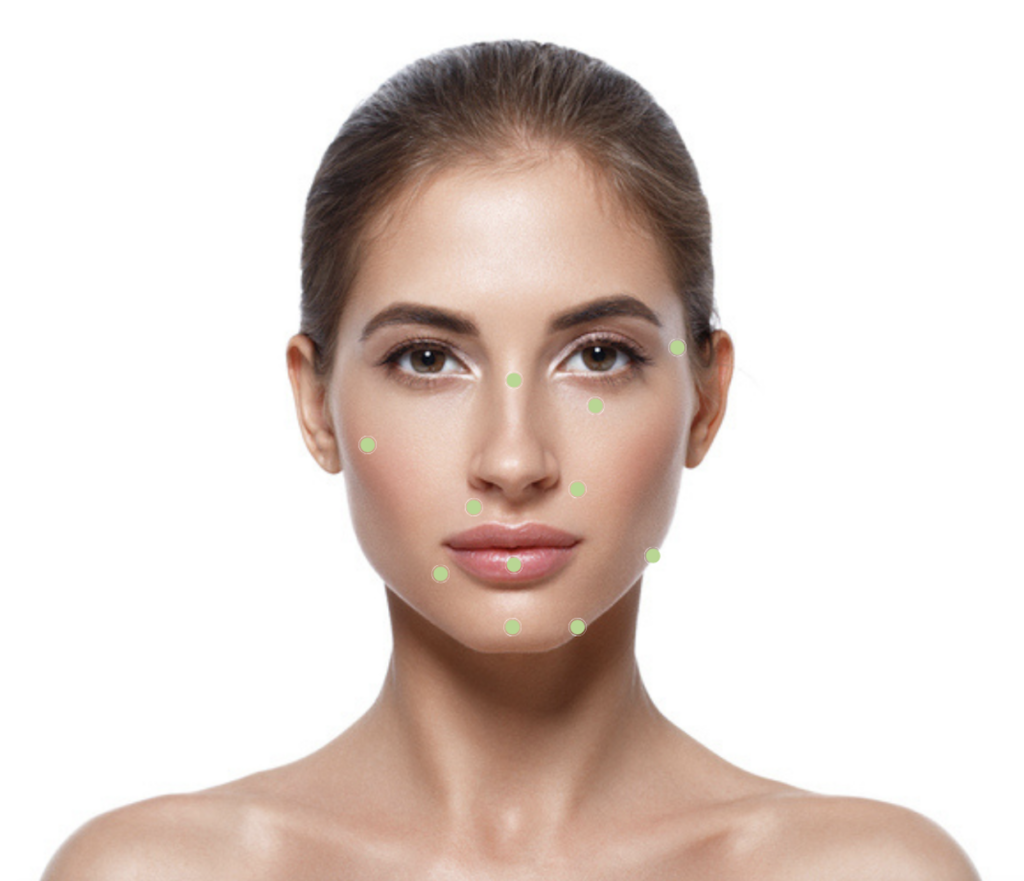 Restylane Juvederm Filler Injection Sites Treatment Areas Middleton Madison WI