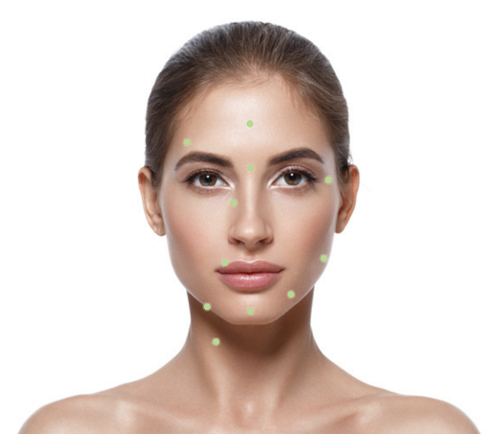 Botox Dysport Injection Sites Treatment Areas Middleton Madison WI